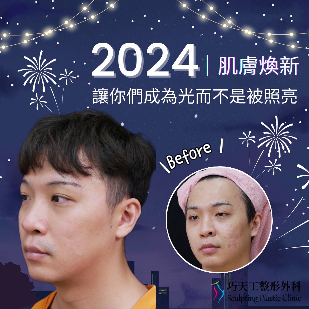 2024 肌膚煥新，讓你們成為光而不是被照亮